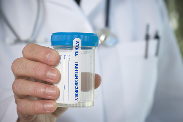 Positive Drug Test Rates Hit 16-year High